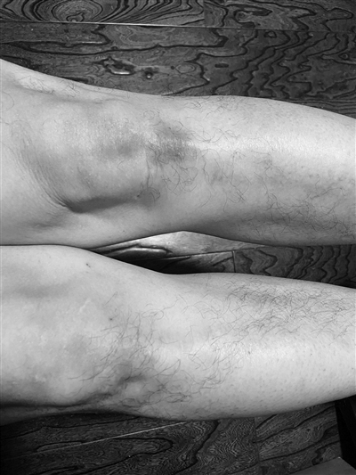 张军桥援鄂医生“摆摊” 专门教市民做心肺复苏