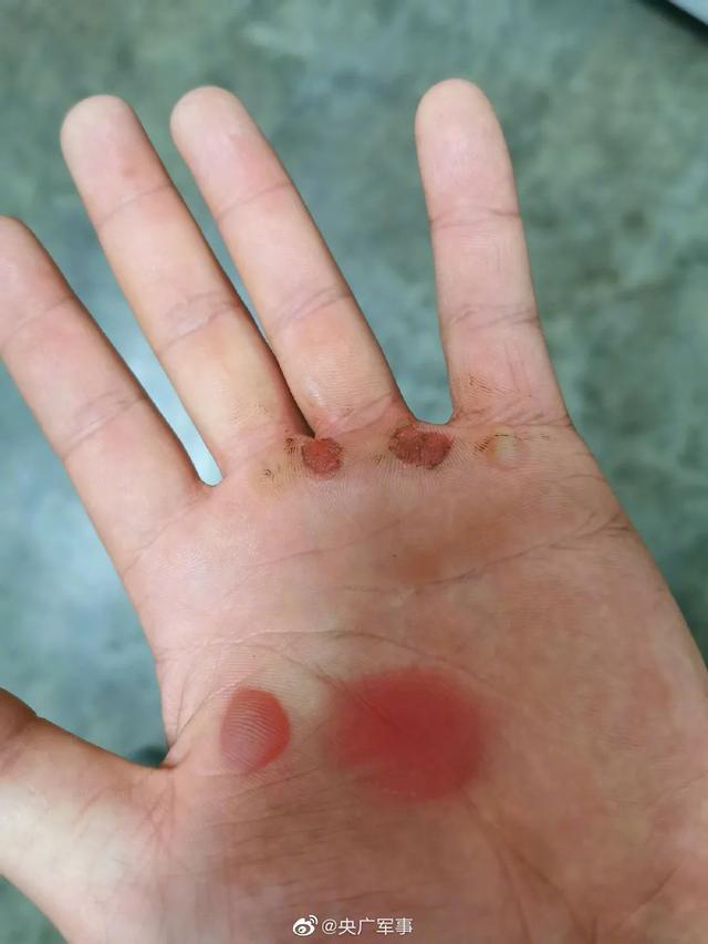 勋章|这样的脸、手、脚……都是你们最帅的样子