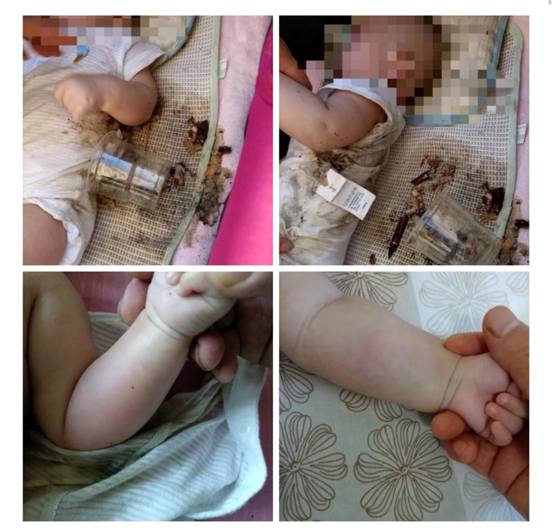 杭州女婴被天降烟灰杯砸中 其母呼吁装防抛物监控