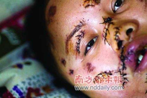 深圳<em>女</em>赴约收债被狂砍60刀仿若<em>凌迟</em> 后备厢里