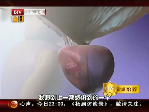 NTV养生堂201307现场直播观看【2345综艺】