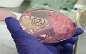 Contaminación de la bacteria escherichia coli 