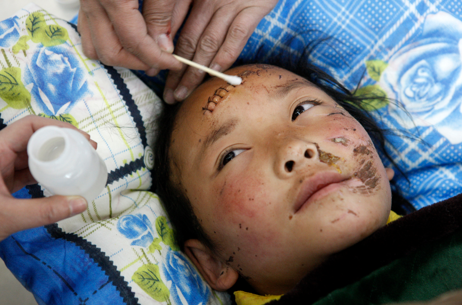 2010年4月19日，在玉树机场，医护人员为在地震中受伤的10岁女孩才文德吉消毒伤口，她将搭乘军用运输机赴西宁接受治疗。新华社记者　沈伯韩摄