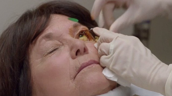 图像:前吸烟者马琳接受眼球注射.