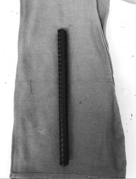 建筑工人钢筋穿体 医院3小时生死救治有惊无险