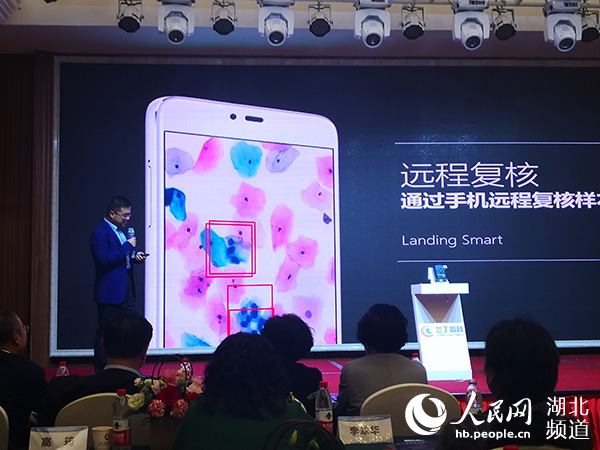 手机 跨界 变身人工智能显微镜癌症诊断进入5g 大数据时代 新闻频道 央视网 Cctv Com