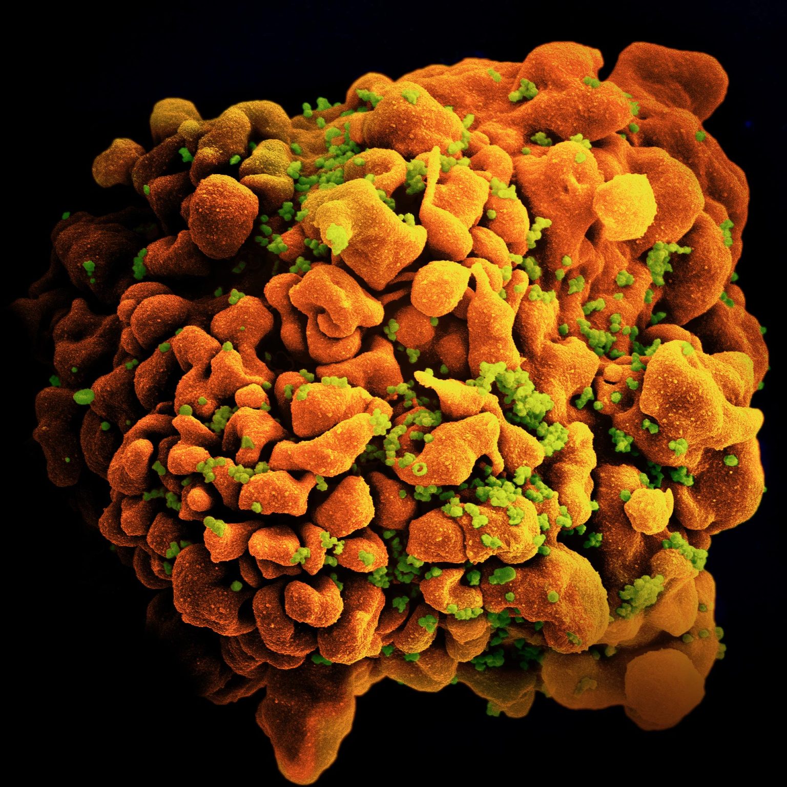 HIV Microscopy in Pictures