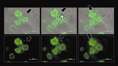图中可见一个自然杀伤细胞（箭头指示处）在摄取绿色癌细胞片段后自身呈现绿色。这一过程揭示了癌细胞如何扮演“劫持者”角色，促使自然杀伤细胞进入休眠状态从而躲避免疫监视。 图片来源：《科学进展》/哈希姆研究团队